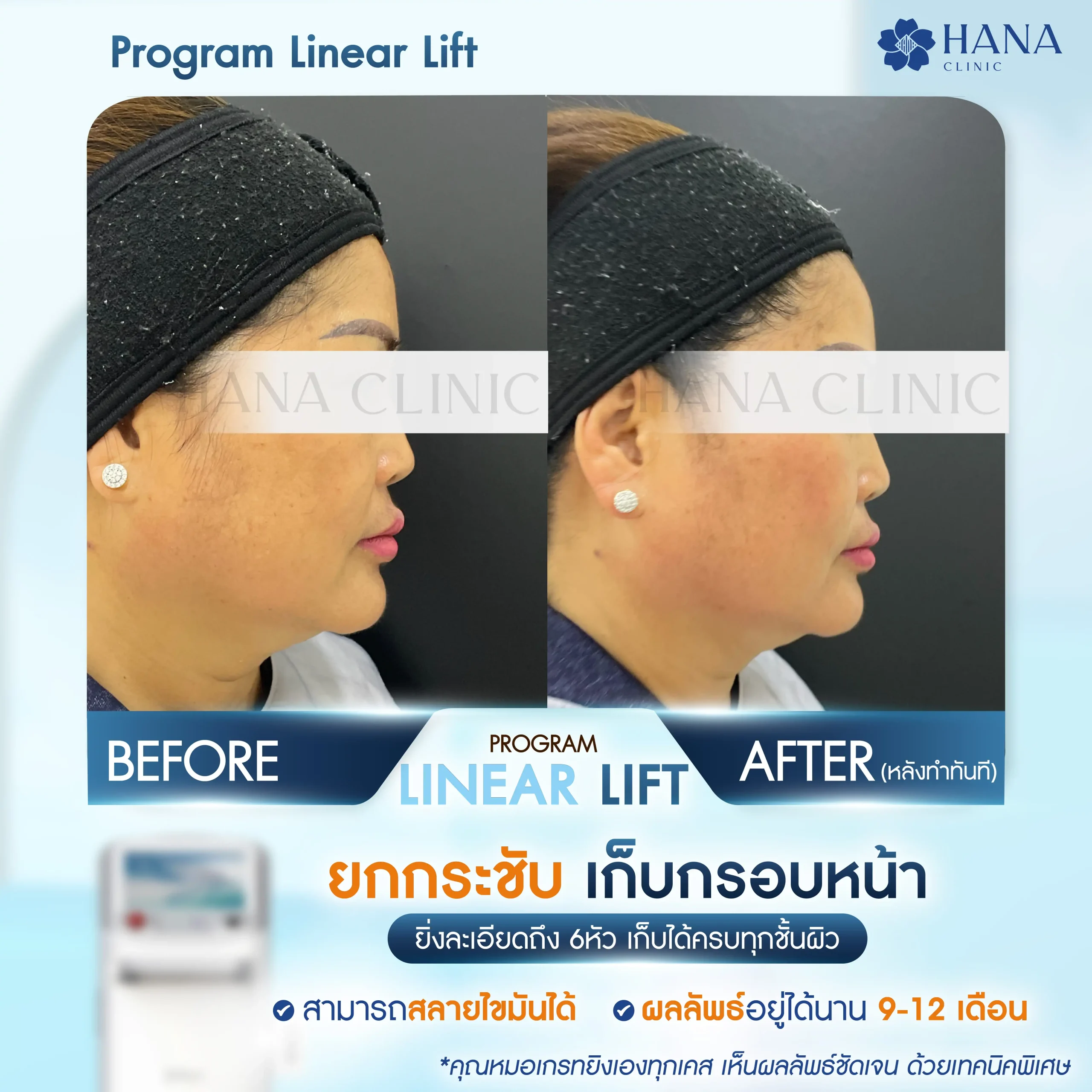 K.Eang nam -01