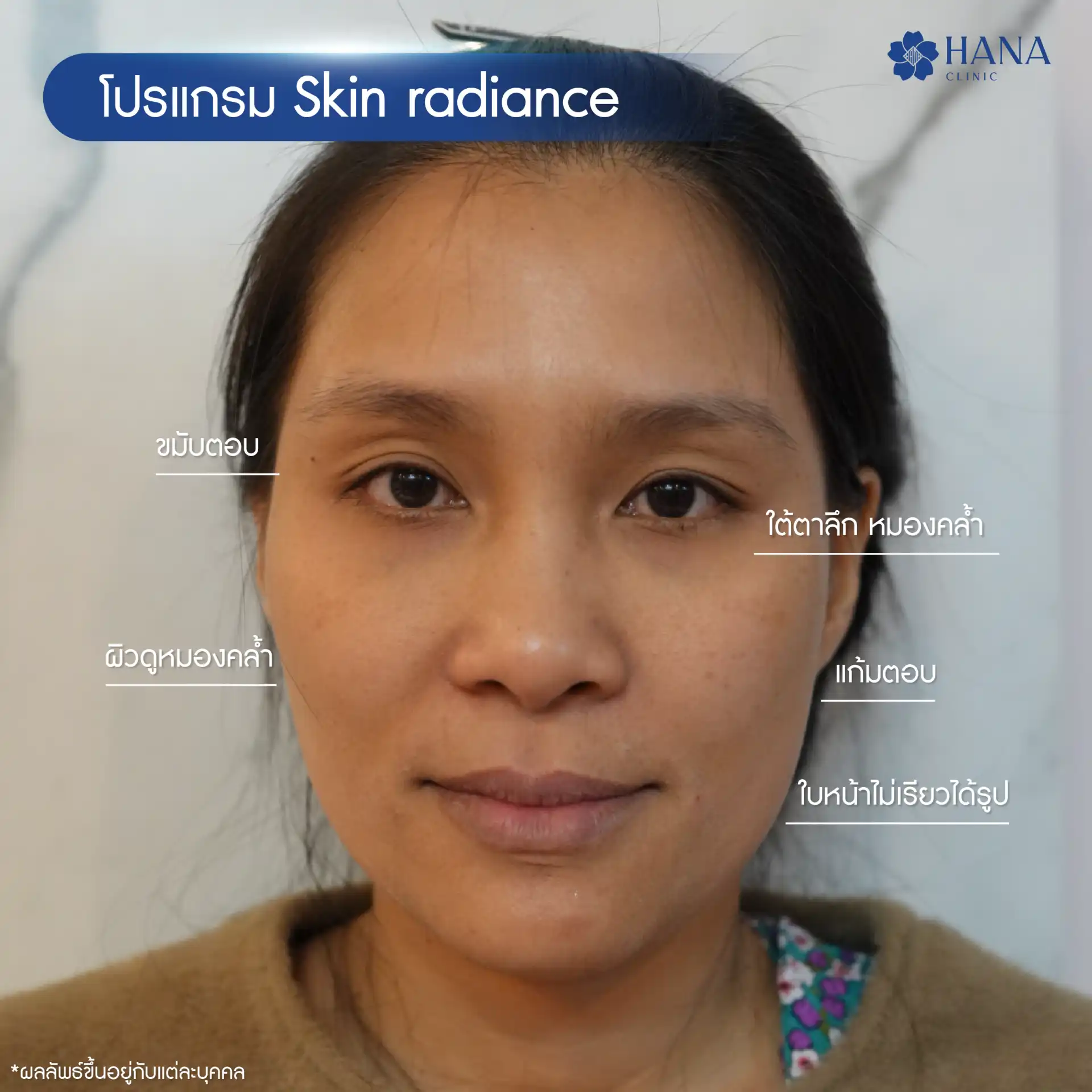 Skin radiance-01