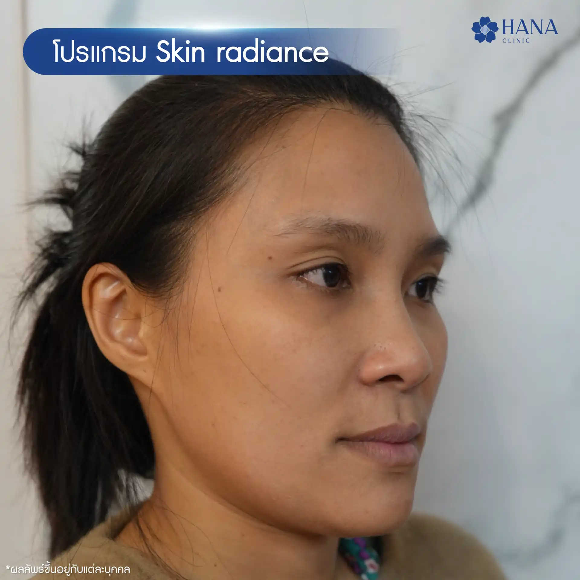 Skin radiance-03