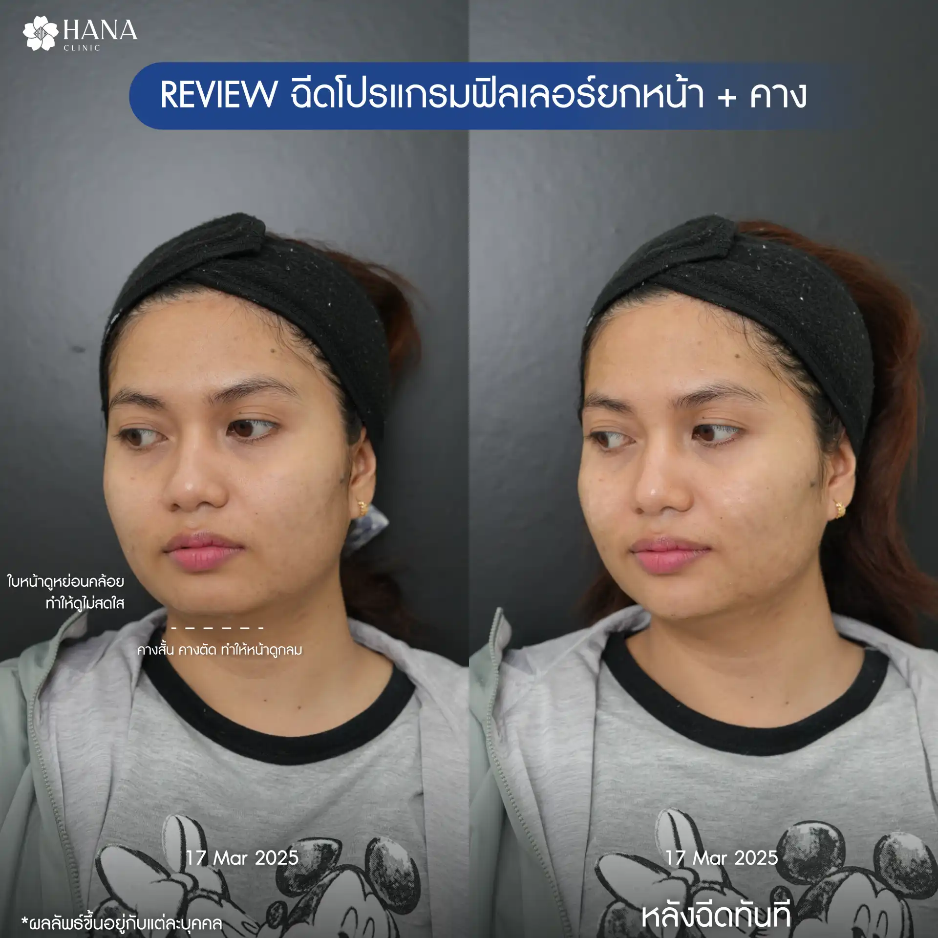BF-AT-K.สุพัตรา-03