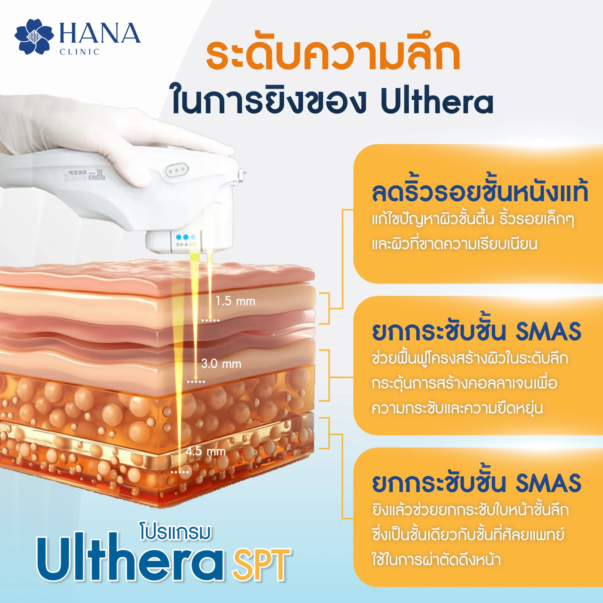 ระดับความลึกในการยิงของulthera