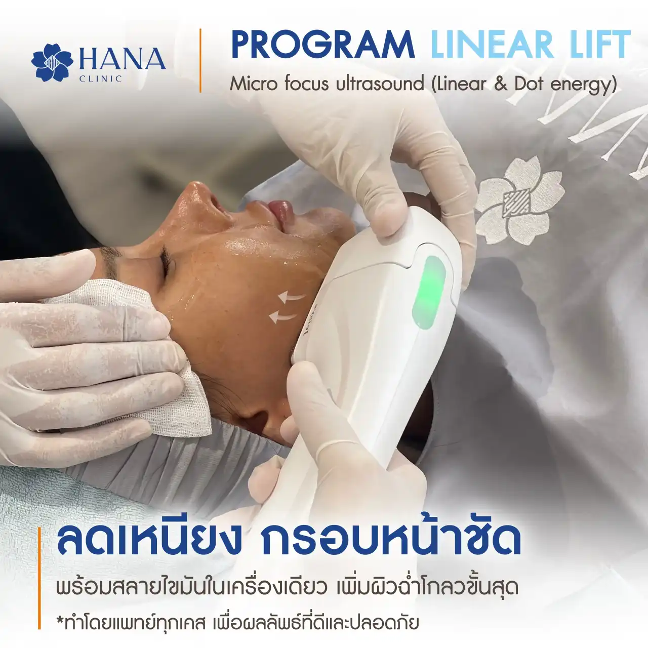 Program Linear Lift