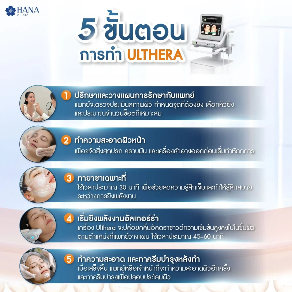 ขั้นตอนการทำ Ulthera