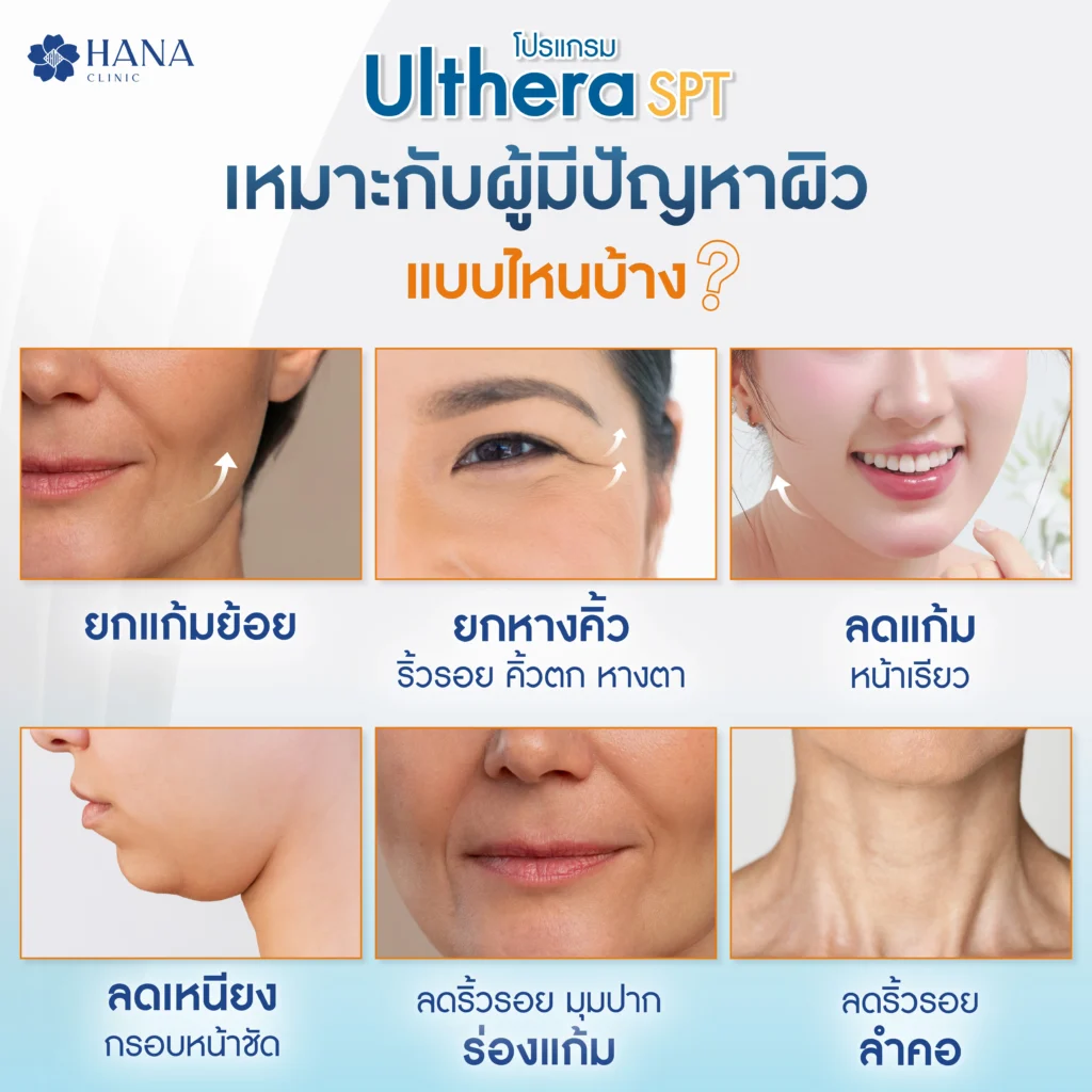ทำ Ulthera เหมาะกับใคร
