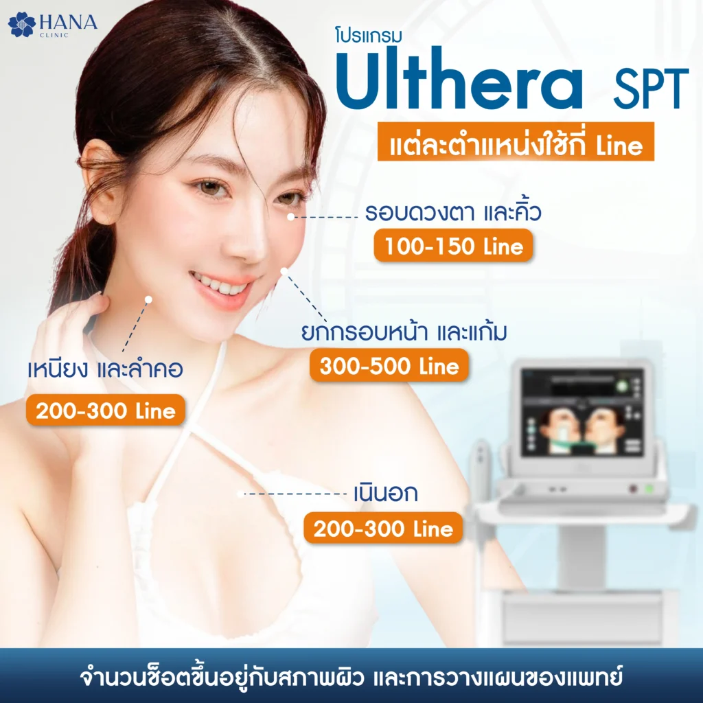 ทำ Ulthera SPT ใช้กี่ไลน์