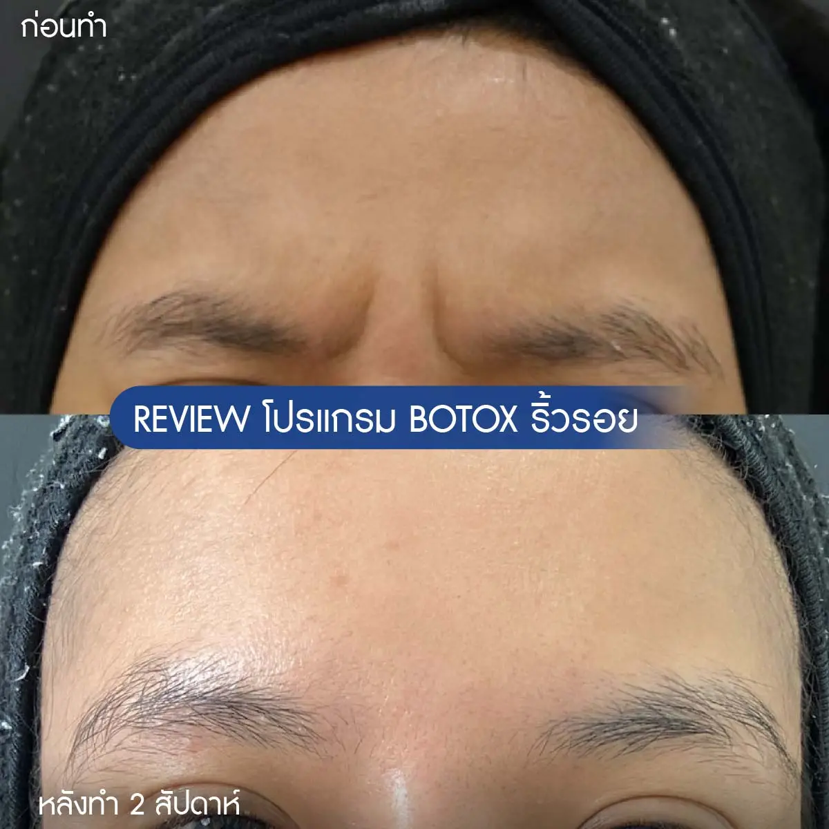 รีวิวโบริ้วรอย-01