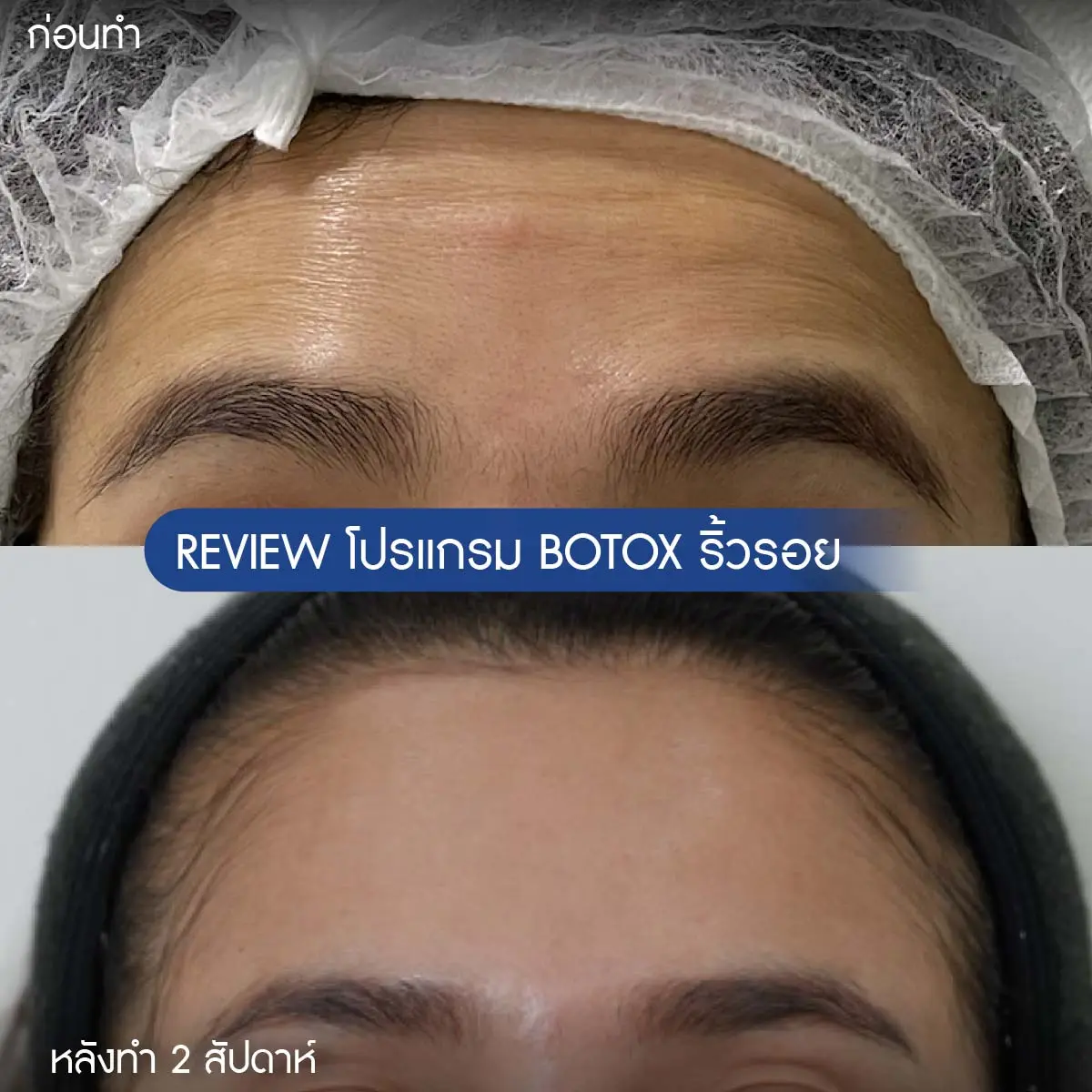 รีวิวโบริ้วรอย-04