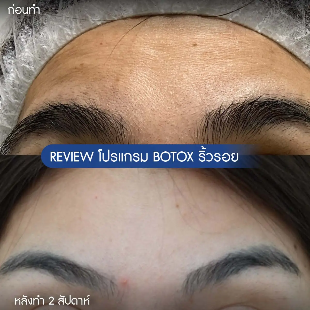 รีวิวโบริ้วรอย-05