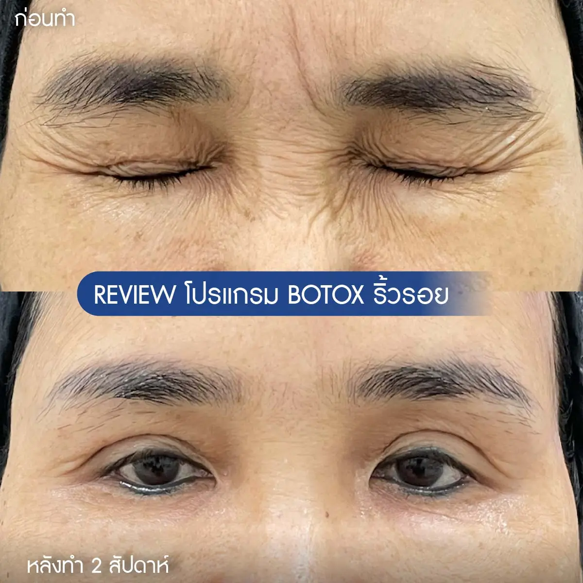 รีวิวโบริ้วรอย-06
