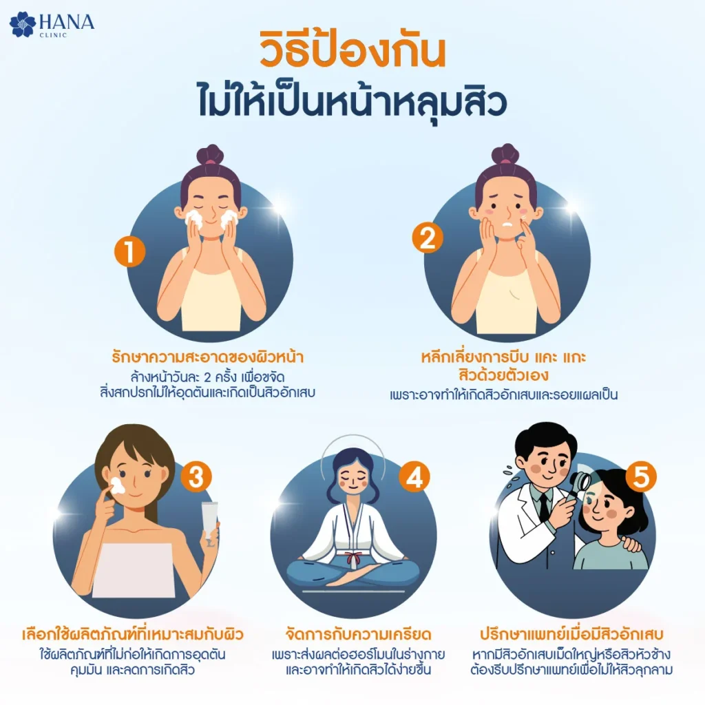 หน้าหลุมสิว