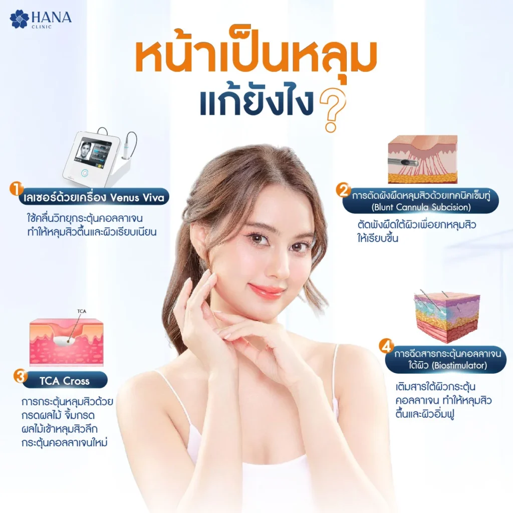 หน้าเป็นหลุมแก้ยังไง