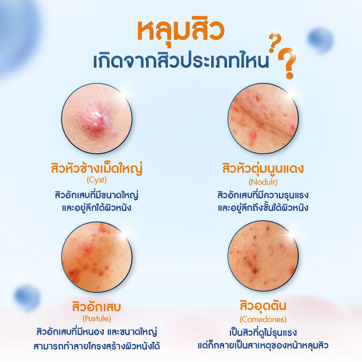 หน้าหลุมสิว