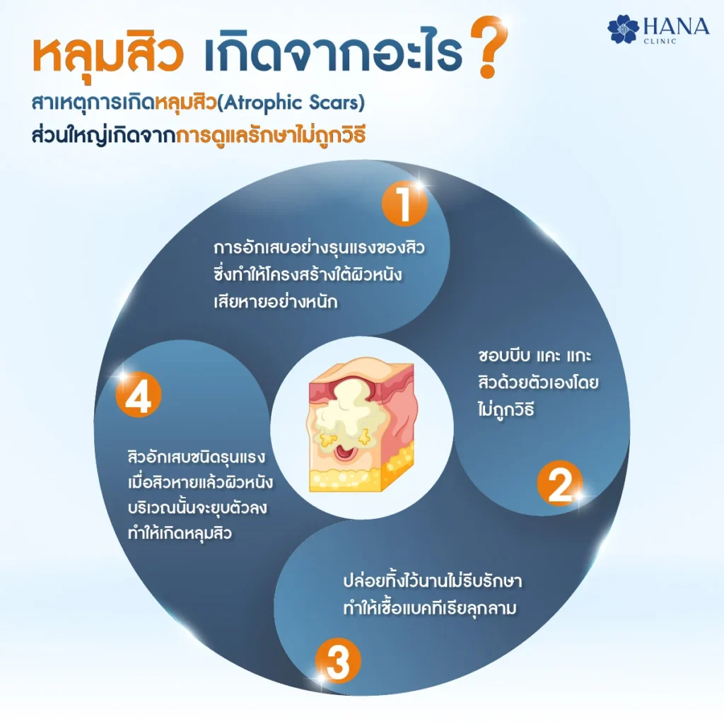 หน้าหลุมสิว