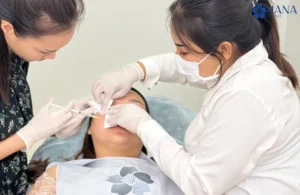 Subcision หลุมสิว